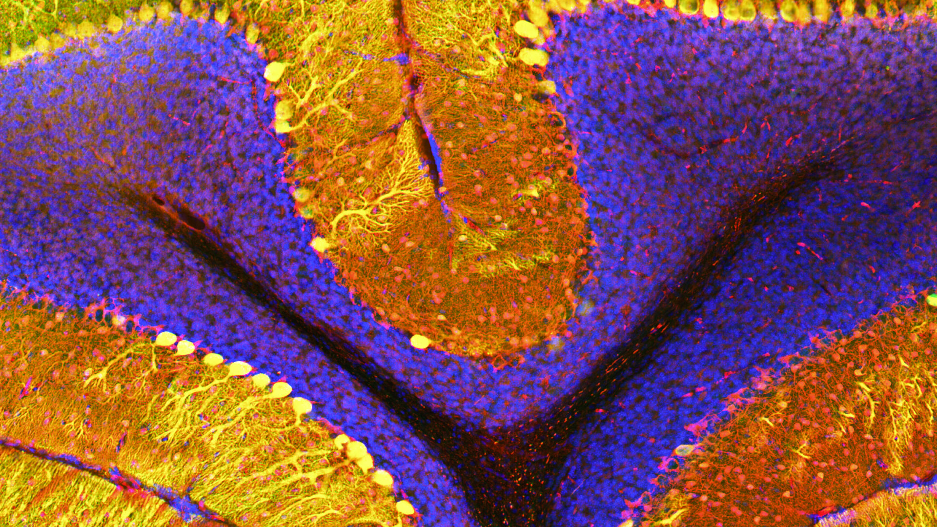 Neurons in mouse brain expressing SAPAP-4.