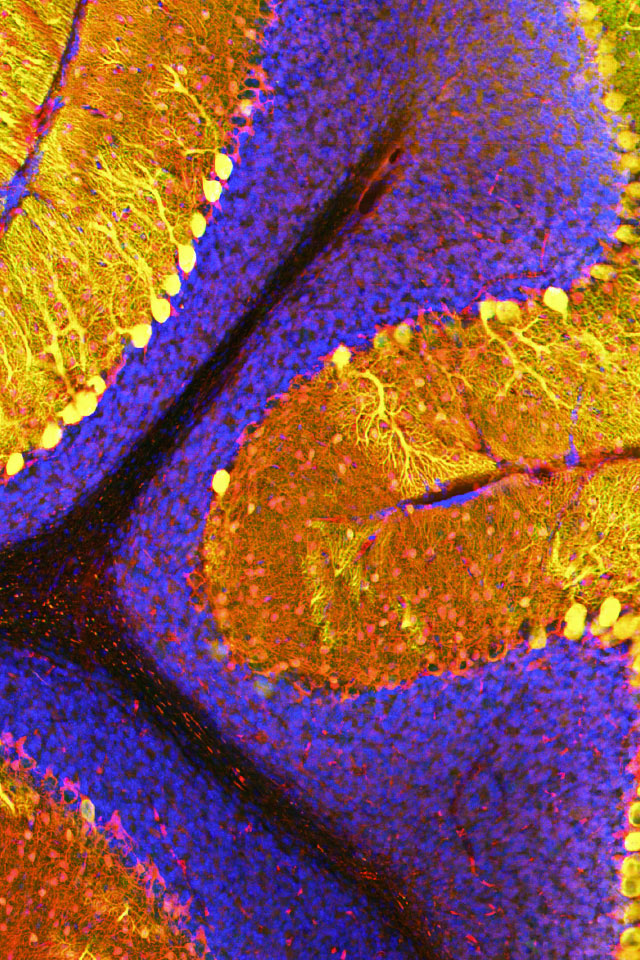 Neurons in the mouse brain expressing SAPAP-4.