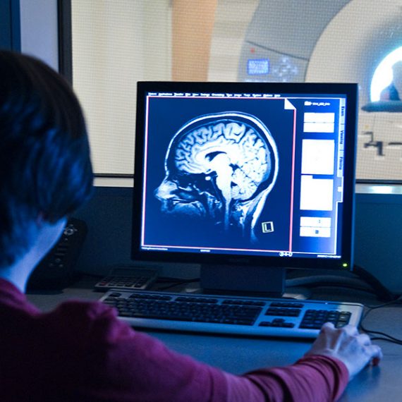 woman looks at brain scan