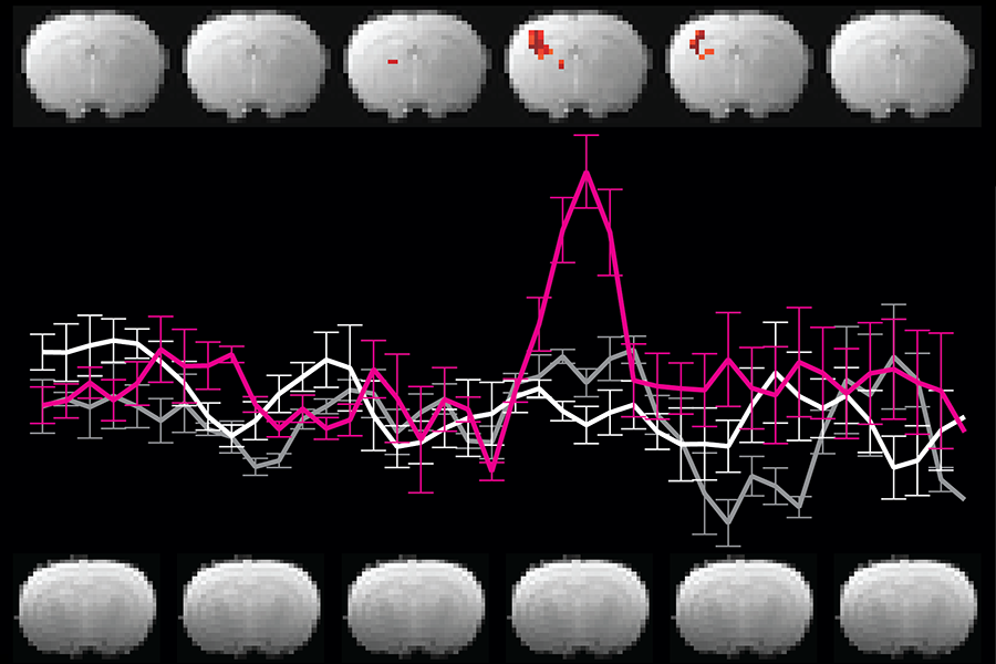 Two rows of brain scans with a line graph in between.