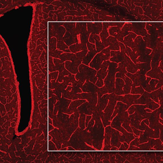 Microscopic image of brain tissue with bright red streaks.