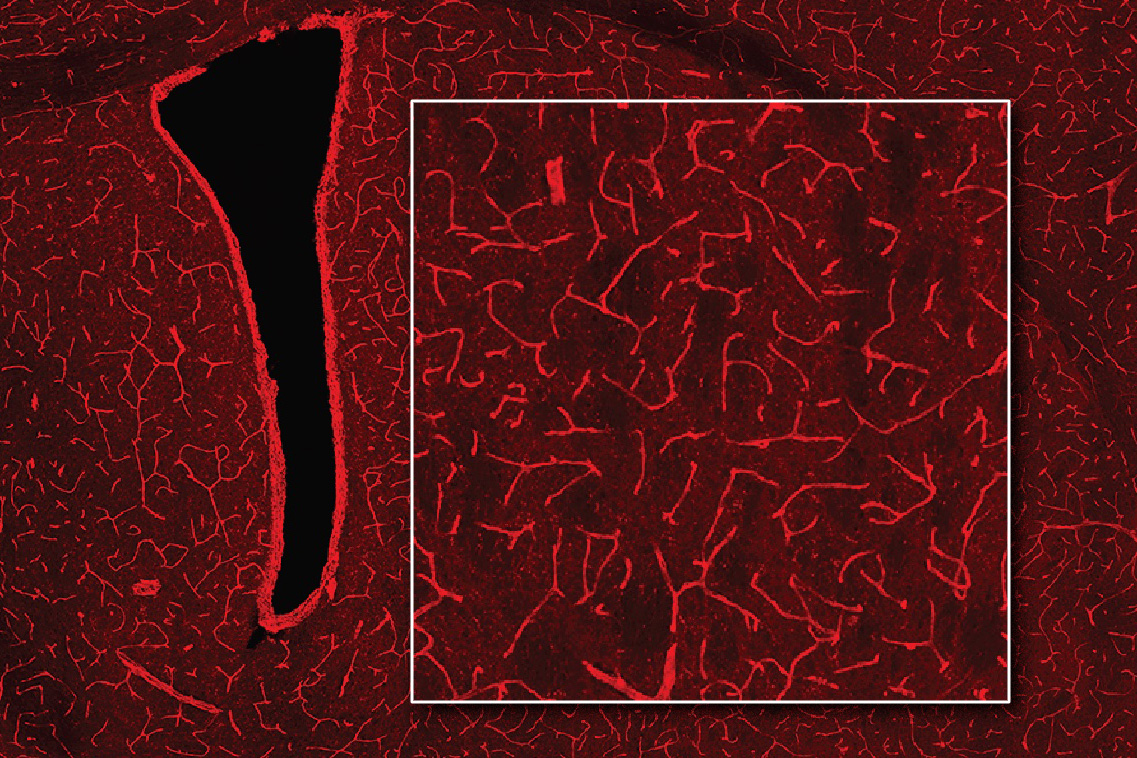 Microscopic image of brain tissue with bright red streaks.